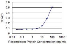 Anti-ELF5 Mouse Monoclonal Antibody [clone: 3D10]