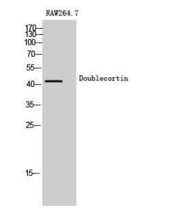 Anti-Doublecortin antibody