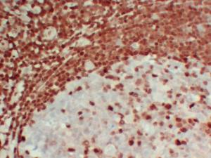 Immunohistochemical analysis of paraffin-embedded human Tonsil-high magnification using Anti-p27Kip1 Antibody