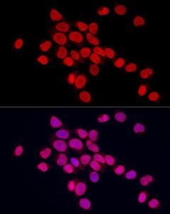 Anti-Lamin A antibody