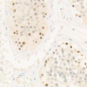 Immunohistochemistry analysis of paraffin-embedded human testis using Anti-Chk2 Antibody [ARC57076] (A306128) at a dilution of 1:300 (40x lens). Perform high pressure antigen retrieval with 10 mM citrate buffer pH 6.0 before commencing with IHC staining protocol.