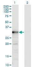 Anti-TYMS Mouse Monoclonal Antibody [clone: 2B2]