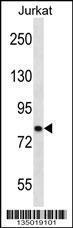 Anti-CACNB2 Rabbit Polyclonal Antibody (AP (Alkaline Phosphatase))