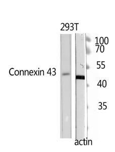 Anti-Doublecortin antibody