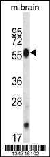 Anti-CLK4 Rabbit Polyclonal Antibody (AP (Alkaline Phosphatase))