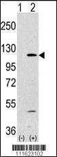 Anti-PI3KCA Rabbit Polyclonal Antibody (Biotin)