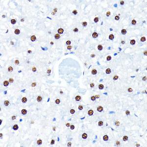 Immunohistochemistry analysis of paraffin-embedded rat liver using Anti-HuR / ELAVL1 Antibody [ARC0101] (A307808) at a dilution of 1:100 (40x lens). Perform microwave antigen retrieval with 10 mM PBS buffer pH 7.2 before commencing with IHC staining protocol.