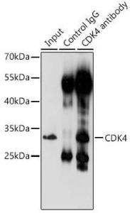 Immunoprecipitation analysis of 200µg extracts of 293T cells using 3µg of Anti-Cdk4 Antibody (A309050). This Western blot was performed on the immunoprecipitate using Anti-Cdk4 Antibody (A309050) at a dilution of 1:1000.