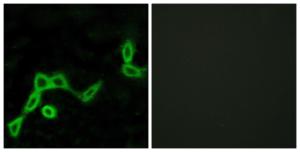 Immunofluorescence analysis of LOVO cells using Anti-KISS1R Antibody. The right hand panel represents a negative control, where the antibody was pre-incubated with the immunising peptide.