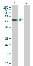 Anti-CDYL2 Mouse Polyclonal Antibody