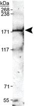 Anti-TRPM2 Rabbit Polyclonal Antibody