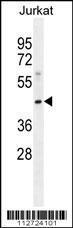 Anti-MOGT3 Rabbit Polyclonal Antibody (APC (Allophycocyanin))