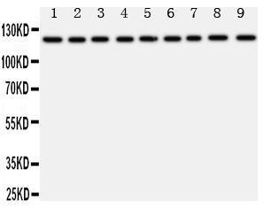 Anti-TRPC3 Rabbit Polyclonal Antibody