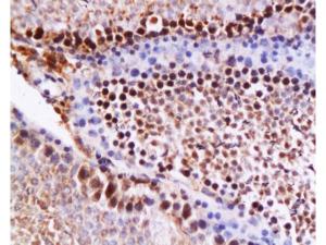 Anti-CASP12 Rabbit Polyclonal Antibody