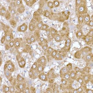 Immunohistochemistry analysis of paraffin-embedded human liver using Anti-ND6 Antibody (A92852) at a dilution of 1:100 (40x lens) Perform high pressure antigen retrieval with 10 mM citrate buffer pH 60 before commencing with IHC staining protocol