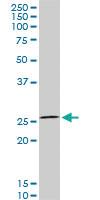 Anti-HOXC12 Mouse Monoclonal Antibody [clone: 2A4]