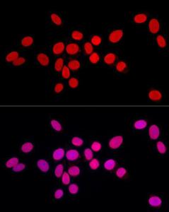 Anti-Lamin A antibody