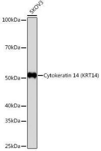 Anti-Cytokeratin 14 Rabbit Monoclonal Antibody [clone: ARC0351]