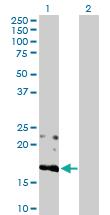 Anti-BST2 Rabbit Polyclonal Antibody