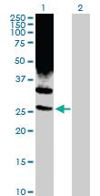 Anti-PSMD10 Rabbit Polyclonal Antibody