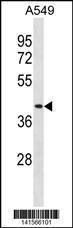 Anti-DPEP1 Rabbit Polyclonal Antibody (FITC (Fluorescein Isothiocyanate))