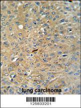 Anti-CASP3 Rabbit Polyclonal Antibody (FITC (Fluorescein Isothiocyanate))