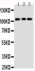 Anti-TRPC6 Rabbit Polyclonal Antibody