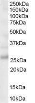 Anti-MOG antibody