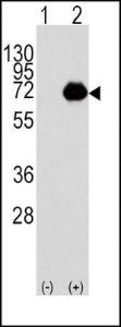 Anti-ACOX1 Rabbit Polyclonal Antibody (AP (Alkaline Phosphatase))