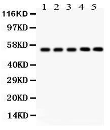 Anti-YBX1 Rabbit Polyclonal Antibody