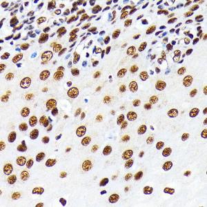 Immunohistochemistry analysis of paraffin-embedded human esophageal using Anti-HuR / ELAVL1 Antibody [ARC0101] (A307808) at a dilution of 1:100 (40x lens). Perform microwave antigen retrieval with 10 mM PBS buffer pH 7.2 before commencing with IHC staining protocol.