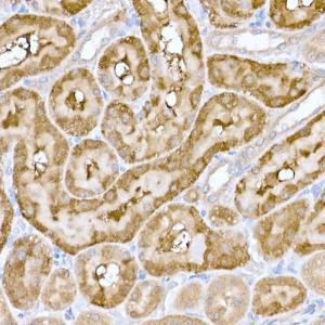 Immunohistochemistry analysis of paraffin-embedded rat kidney using Anti-ND6 Antibody (A92852) at a dilution of 1:100 (40x lens) Perform high pressure antigen retrieval with 10 mM citrate buffer pH 60 before commencing with IHC staining protocol