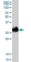 Anti-BST2 Rabbit Polyclonal Antibody