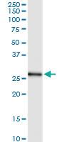 Anti-PSMA7 Polyclonal Antibody Pair