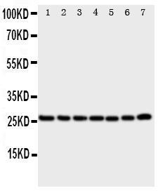 Anti-SIAH Interacting Protein Rabbit Polyclonal Antibody