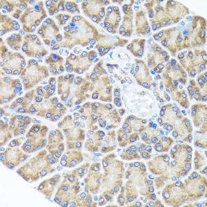 Immunohistochemistry analysis of paraffin-embedded rat pancreas using Anti-Spry-2 Antibody [ARC1753] (A306129) at a dilution of 1:100 (40X lens). Perform microwave antigen retrieval with 10 mM Tris/EDTA buffer pH 9.0 before commencing with IHC staining protocol