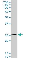 Anti-HOXC12 Mouse Monoclonal Antibody [clone: 2A4]