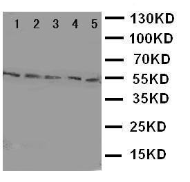 Anti-HYAL2 Rabbit Polyclonal Antibody