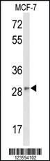 Anti-DAGLB Rabbit Polyclonal Antibody