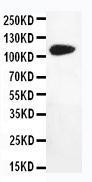 Anti-DPYD Rabbit Polyclonal Antibody