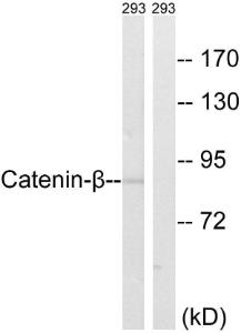 Western blot analysis of lysates from 293 cells using Anti-Catenin-beta Antibody. The right hand lane represents a negative control, where the Antibody is blocked by the immunising peptide