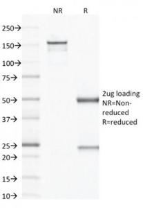 SDS-PAGE analysis of Anti-VEGF Antibody [VG1] under non-reduced and reduced conditions; showing intact IgG and intact heavy and light chains, respectively. SDS-PAGE analysis confirms the integrity and purity of the antibody.