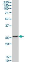 Anti-HOXC12 Mouse Monoclonal Antibody [clone: 2A4]