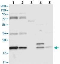 Anti-CHCHD4 Rabbit Polyclonal Antibody