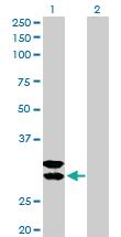 Anti-TPSAB1 Rabbit Polyclonal Antibody