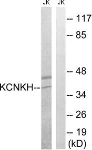 Western blot analysis of lysates from Jurkat cells using Anti-KCNK17 Antibody. The right hand lane represents a negative control, where the antibody is blocked by the immunising peptide