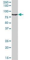 Anti-RACGAP1 Mouse Monoclonal Antibody [clone: 1G6]