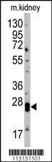 Anti-CLDN1 Rabbit polyclonal antibody