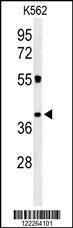 Anti-CD300LF Rabbit Polyclonal Antibody (FITC (Fluorescein Isothiocyanate))