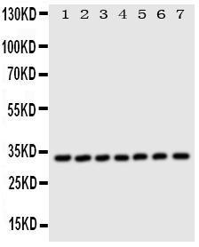 Anti-DCI Rabbit Polyclonal Antibody